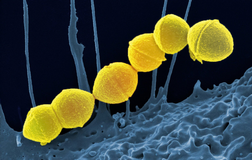 Streptococcus Pyogenes / Unsplash Streptococcus Pyogenes / Unsplash