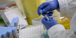 Άλυτο μυστήριο παραμένει η προέλευση του Covid - Τι αναφέρει νέα μελέτη του ΠΟΥ Άλυτο μυστήριο παραμένει η προέλευση του Covid - Τι αναφέρει νέα μελέτη του ΠΟΥ