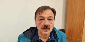 Βόλος: Ξυλοδαρμός δημοτικού συμβούλου από μασκοφόρο συνεργάτη του Μπέου Βόλος: Ξυλοδαρμός δημοτικού συμβούλου από μασκοφόρο συνεργάτη του Μπέου