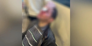 Επίθεση στη Νομική: «Απειλούμασταν καιρό, ο φοιτητής χτυπήθηκε με δολοφονική διάθεση» Επίθεση στη Νομική: «Απειλούμασταν καιρό, ο φοιτητής χτυπήθηκε με δολοφονική διάθεση»