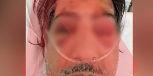 Δρομολόγιο του τρόμου στα Άνω Λιόσια: Πέταξαν τσιμεντόλιθο σε οδηγό λεωφορείου! Δρομολόγιο του τρόμου στα Άνω Λιόσια: Πέταξαν τσιμεντόλιθο σε οδηγό λεωφορείου!
