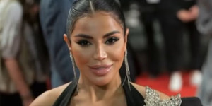 Γαλλία: Άγρια επίθεση σε influencer στο σπίτι της - Την γρονθοκόπησαν και την «έλουσαν» με χλωρίνη Γαλλία: Άγρια επίθεση σε influencer στο σπίτι της - Την γρονθοκόπησαν και την «έλουσαν» με χλωρίνη